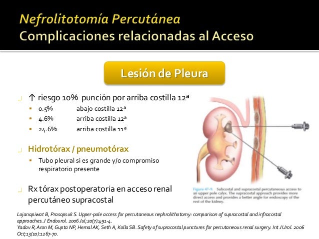 Nefrolitotomia Percutanea Epub